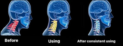 NeckEase / Neck Tension Reliever